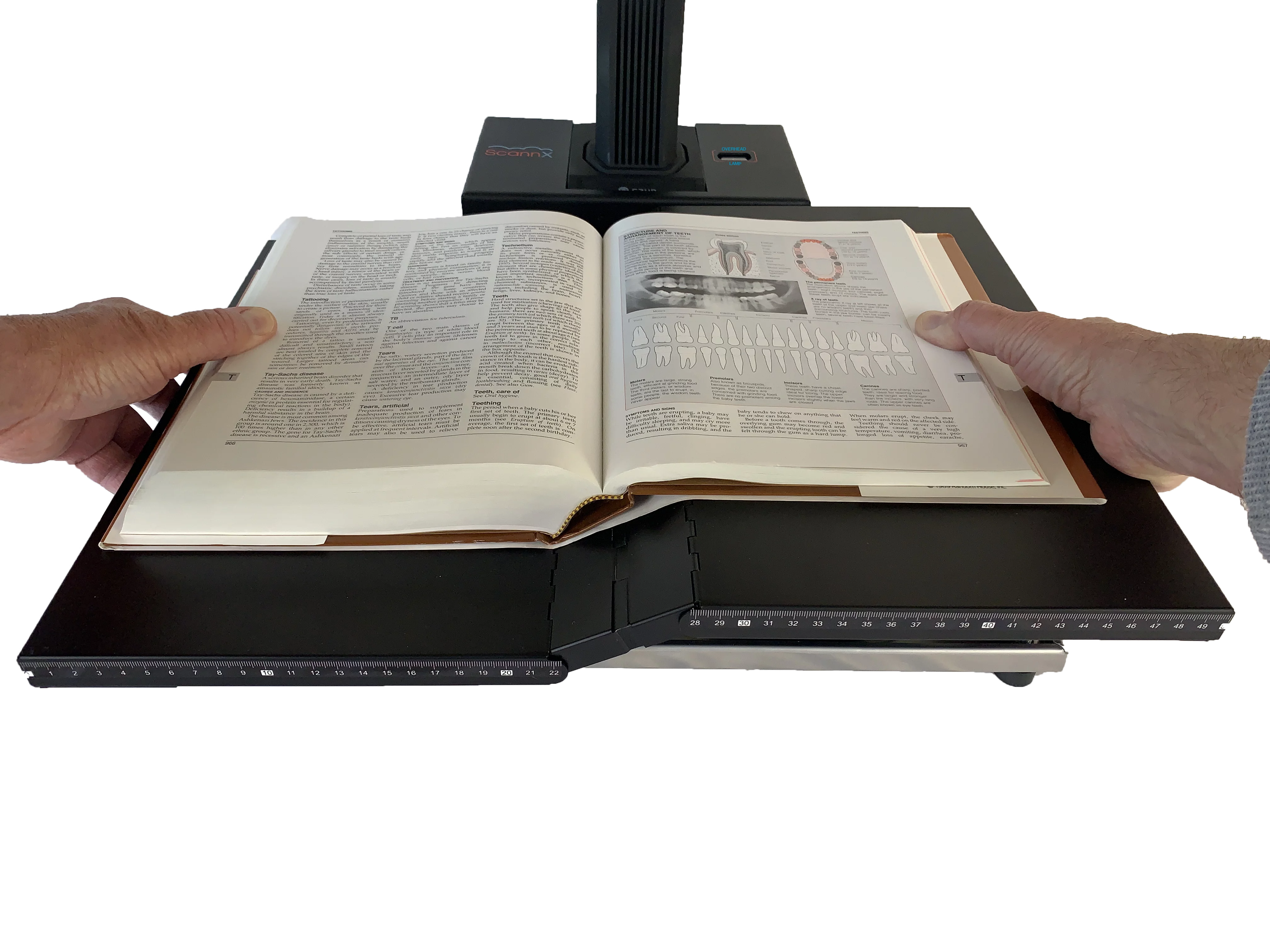 ScannX SmartCradle